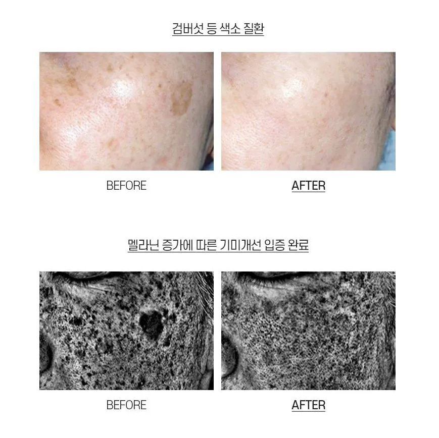Melanon X Cream 30ml MEDIPEEL+